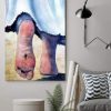 Injured Feet Of God Canvas